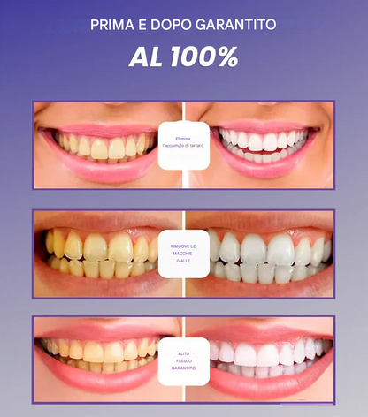 SIERO SORRISO VIOLA CORRETTORE DEL COLORE DENTALE V34